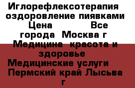 Иглорефлексотерапия, оздоровление пиявками › Цена ­ 3 000 - Все города, Москва г. Медицина, красота и здоровье » Медицинские услуги   . Пермский край,Лысьва г.